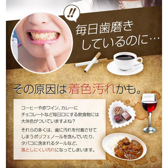 シャインスマイル ホワイトニングキット Shine Smile Whitening Kit 歯