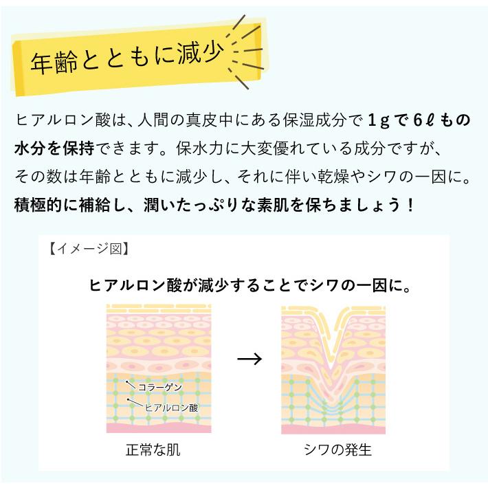 EARTHEART（アースハート） 【在庫限りで販売終了】アースハート
