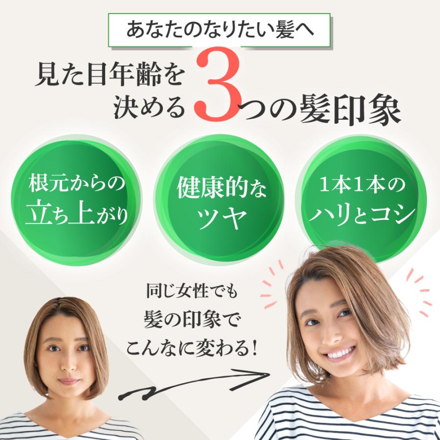 ★リニューアル★美容室専売品 アースハート 頭皮用化粧水 ボリュームアップ スキャルプローション150ml サロン専売 フケ・痒み・乾燥のお悩み スカルプ | EARTHEART | 03