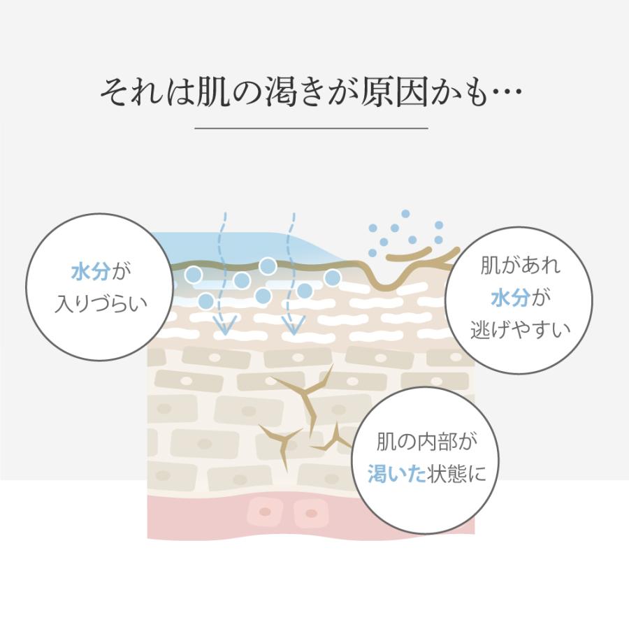 EARTHEART（アースハート） 化粧水 サロン専売 SC リッチローション