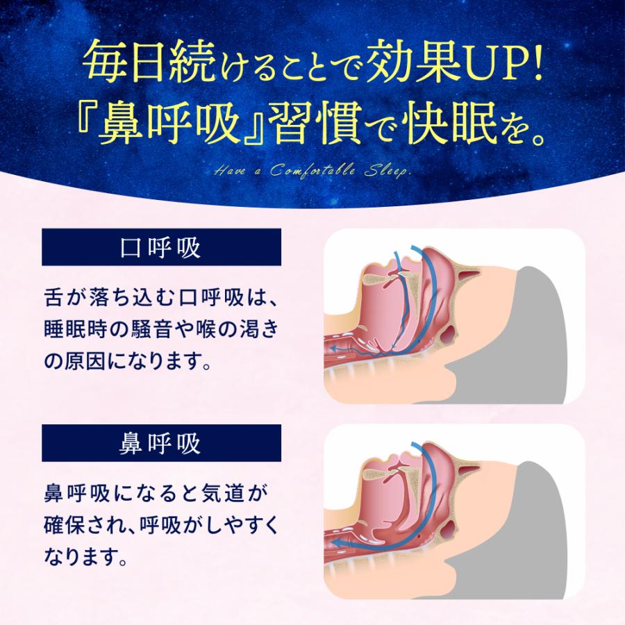 いびき撃退q A どうやったら止められる いびきを止める寝方 枕などのアイテム Baila いびき止めベルトアンチいびき Cpap 調節可能なチンの革紐睡眠無呼吸顎の解決 Ciudaddelmaizslp Gob Mx