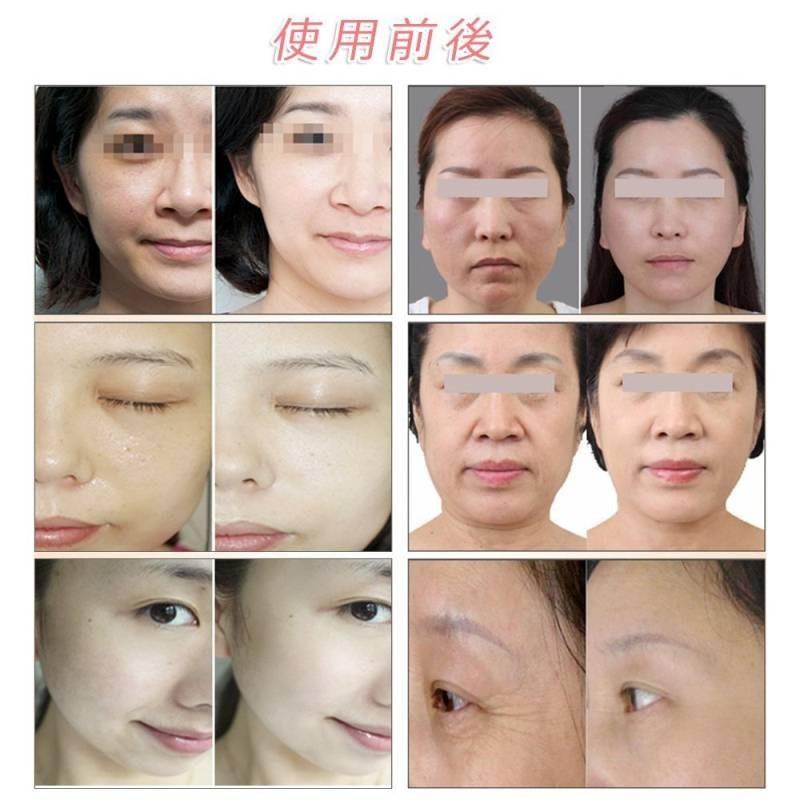 Hifu 美顔器 家庭 業務サロン両用ウルセラ 超音波 Rfラジオ波 Led搭載超音波フェイシャル 毛穴 Rfラジオ波 美顔 美肌 目元用替えチップ付 限定セール Hifu 001a ハッピー ラズベリーパイ 通販 Yahoo ショッピング