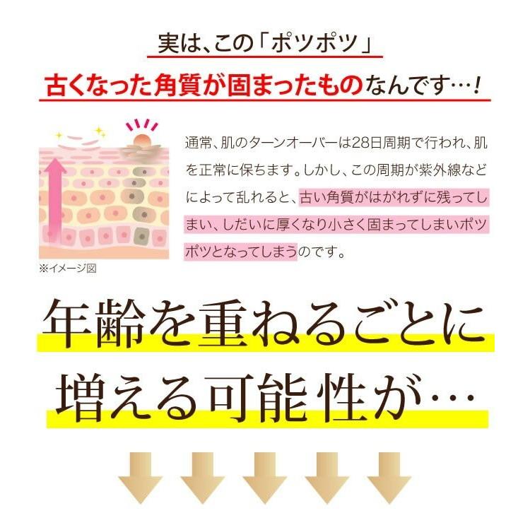 イポケアEX 18ml×３本セット お肌のポツポツ悩みをすっきり解消  ヨクイニン 美容液 美容｜happylife-shop2｜04