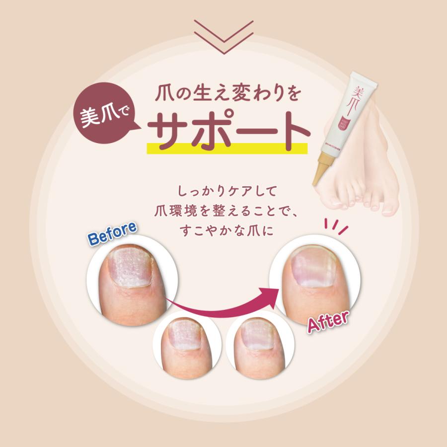 送料無料】美爪 15g×3本セット！ 足爪用ネイルケアジェル 塗るだけ