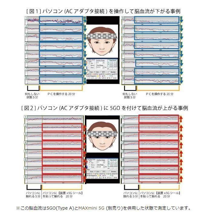 【送料無料】5GO Type A （ブラック/ホワイト/ピンク/ブルー）×３個セット ユニカ 電磁波防止 電磁波対策 ユニカ 電磁波防止グッズ 丸山 電磁波カット 電波の画像