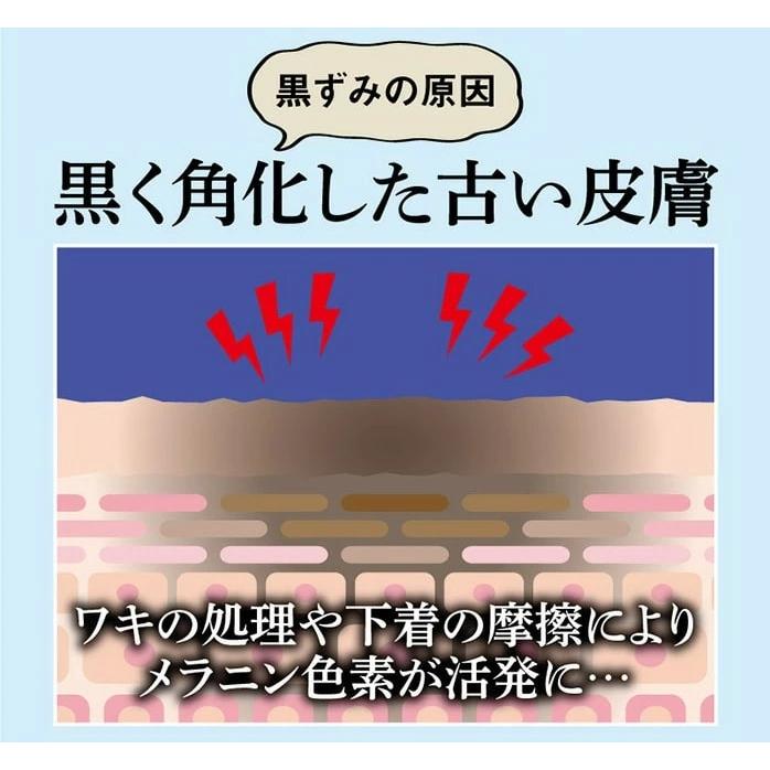 2本！リピーター&フォロワー価格| デリケートゾーン ピーリング 楽天市場】デリケートゾーン ピーリング（ピーリング