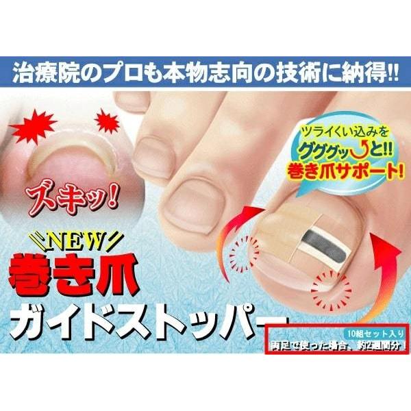 送料無料】 NEW 巻き爪ガイドストッパー 【ポイント10倍】 足の巻き爪