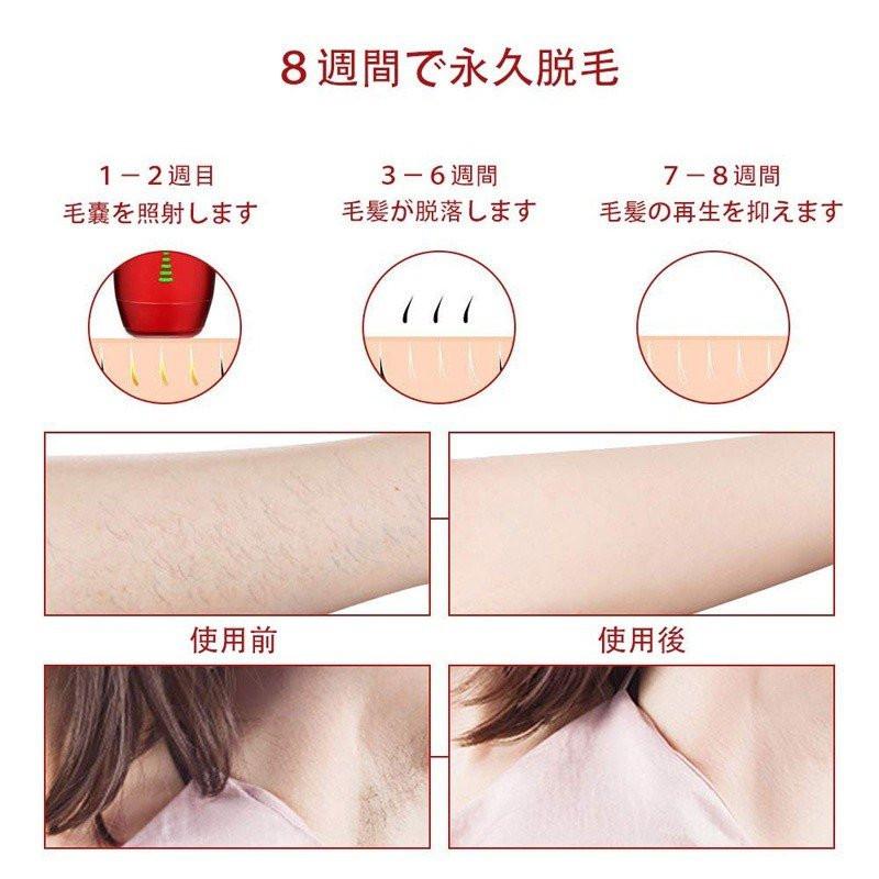 市場 Hatsubi光脱毛器 レディース メンズ 背中 全身ムダ毛処理 顔 腕 わき Vio 足