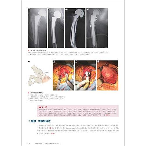 BHA・THA 人工股関節置換術パーフェクト?人工骨頭置換術・人工股関節全置換術の基本とコツ BHA THA 手術までの準備 術前計画