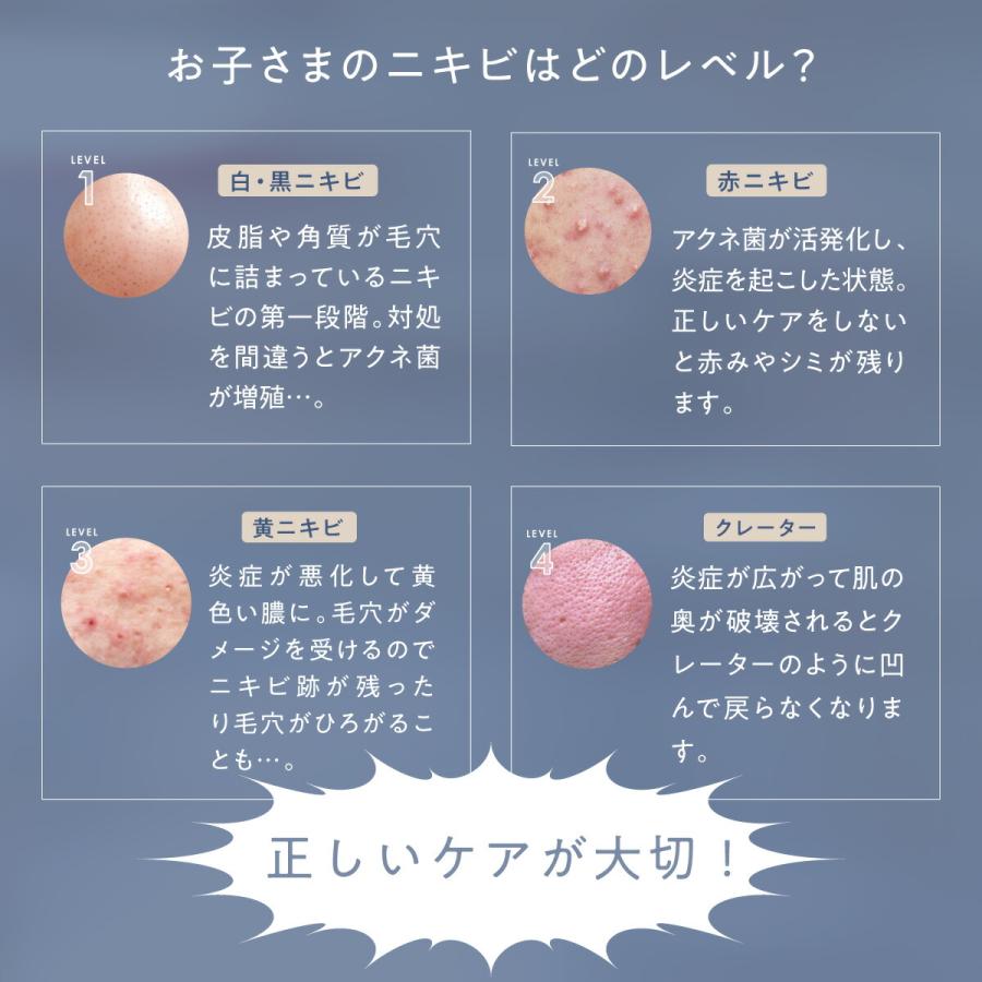 トワs2エール（トワニエール） 【公式】 imuDrop ゼリー洗顔 ニキビ