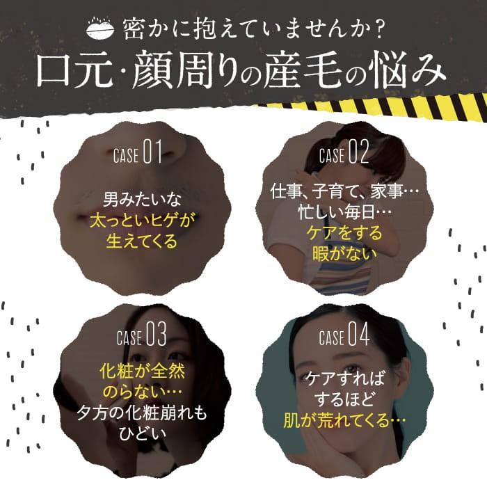抑毛クリーム つるりんと ヒゲ ひげ 産毛 うぶ毛 口まわり 口元 顔 抑毛 指毛 クリーム ムダ毛 むだ毛 抑毛剤 処理 送料無料 22g Trr01 Y ハレル屋 正規取扱店 通販 Yahoo ショッピング