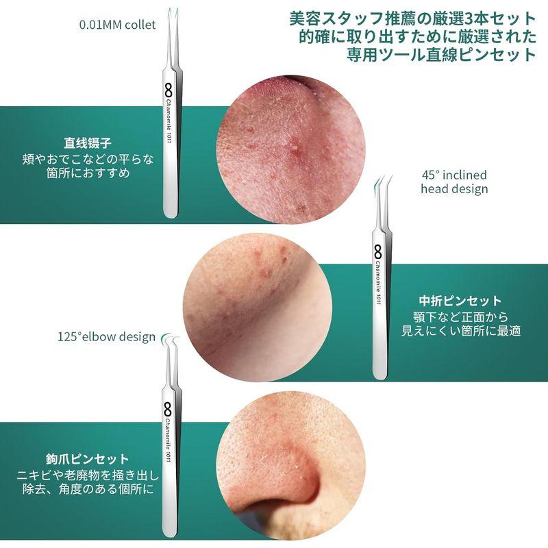 ピンセット角栓コメドプッシャーステンレス製3本セット角栓取り角栓 ピンセット精密毛抜きニキビ 先端0.01? ニキビ取り 黒ずみ取り 毛穴ケ｜haru-online｜06