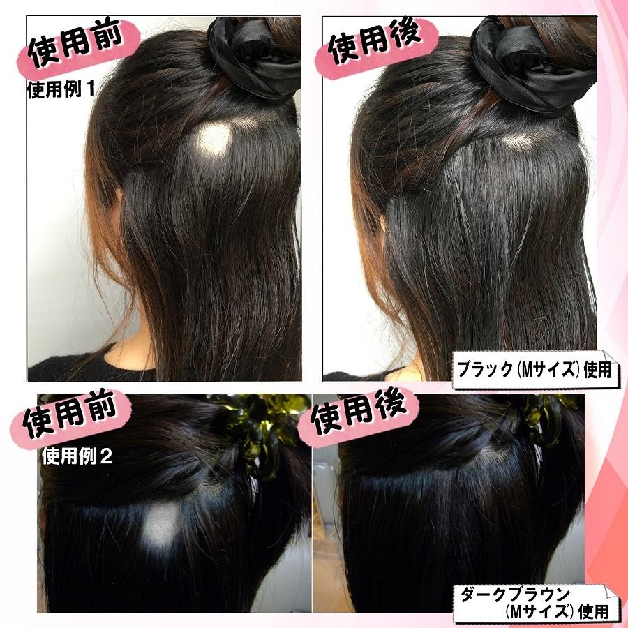 円形脱毛症 隠し方 部分 ウィッグ エクステ つけ毛 Mサイズ