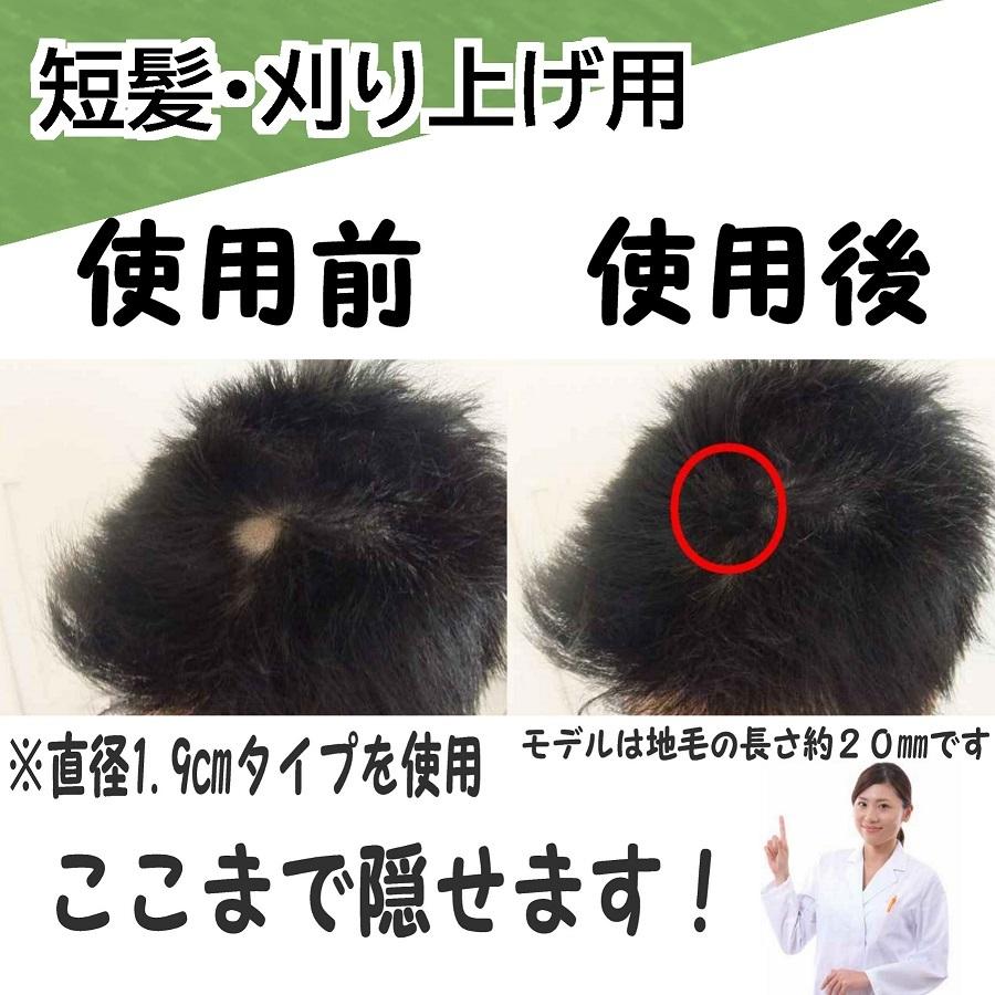 メンズ円形脱毛症 部分ウィッグ男性 短髪 刈り上げ 円形脱毛症かつら