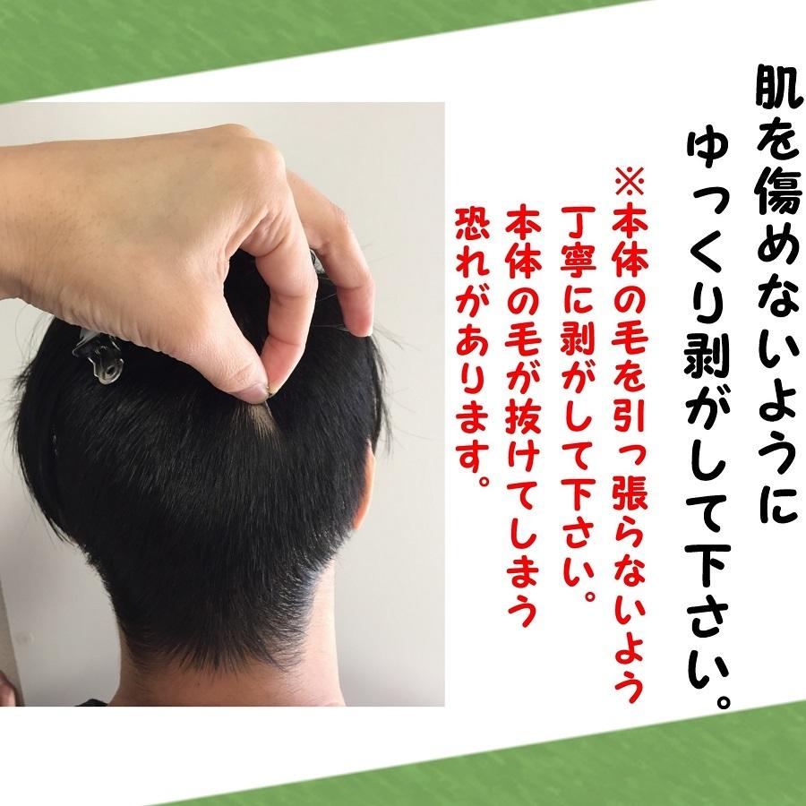 メンズ円形脱毛症 部分ウィッグ男性 短髪 刈り上げ 円形脱毛症かつら