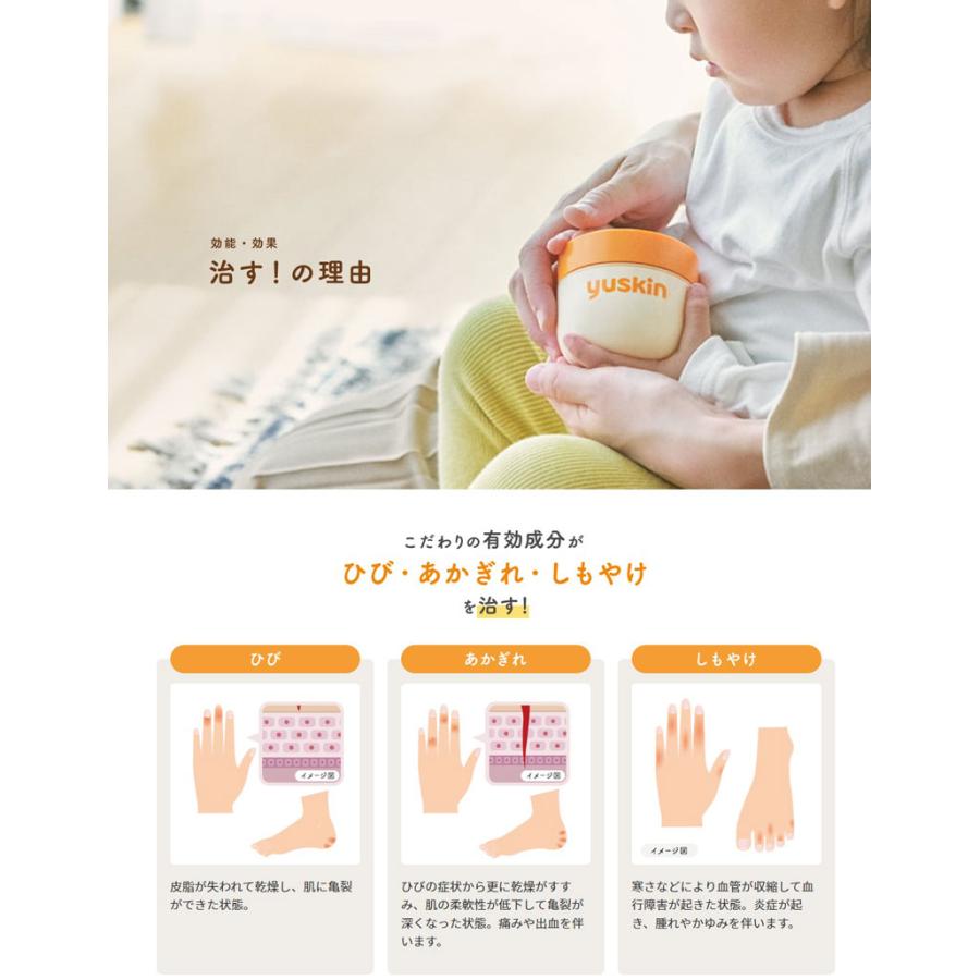 ハンドクリーム ユースキンA ポンプ 180g 大容量 ユースキン製薬