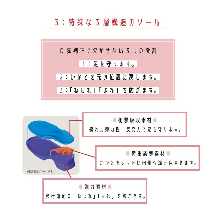アーチフィッター O脚 402 ブラック S/M/L サイズ レディース アーチフィッター O脚 402 ブラック S/M/L サイズ レディース