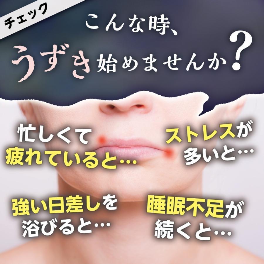 リジン サプリメント 3袋セット 国内即発送 ヘルペス 国内生産 マルチビタミン 180粒30日 60日分 mg配合 うるつやリジン 葉酸