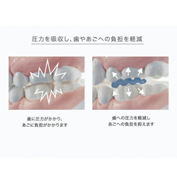 歯ぎしりピタリ ストロング×2個セット 安眠マウスピース 歯ぎしり 食いしばり 対策 防止 予防 歯ぎしり対策 食いしばり対策 日本製 | PROIDEA | 05