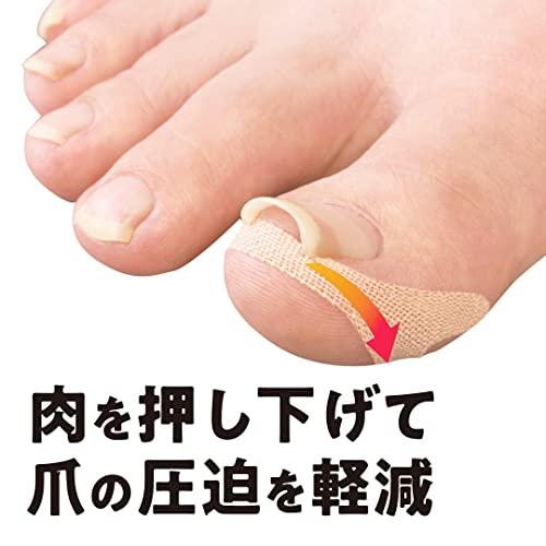 サイプラス 巻き爪 テープ クイこまーぬ 60枚入 爪で食い込んでいる部位に押し下げて貼る 爪との圧迫軽減 剥がれにくい |  | 01