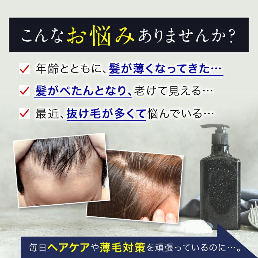 HORMO 育毛剤 ホルモプレミアム ヘアグロウエッセンス 80ml 医薬 HORMO 育毛剤 ホルモプレミアム ヘアグロウエッセンス 80ml 医薬