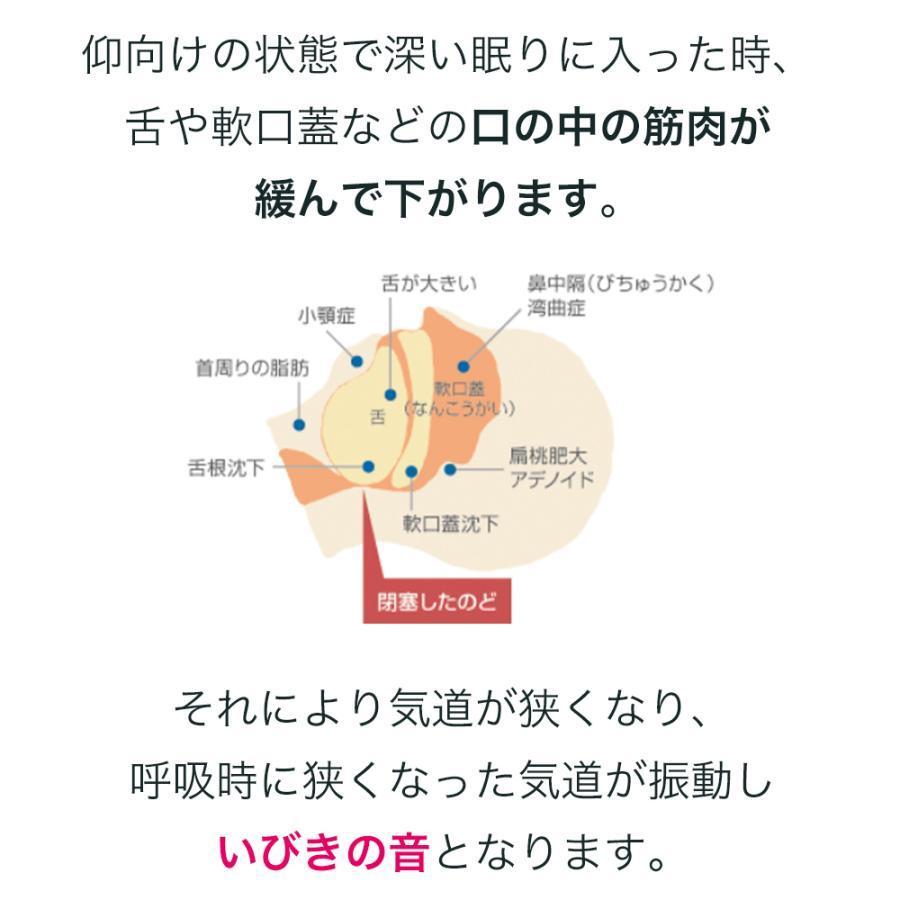 【2026年1月8日以降の発送予定】 いびき グッズ いびき防止 グッズ いびき 治し方 グッズ いびき対策 いびき軽減 スノアサークルプラス Snore Circle PLUS YA1323 【1874856365】(9524円)