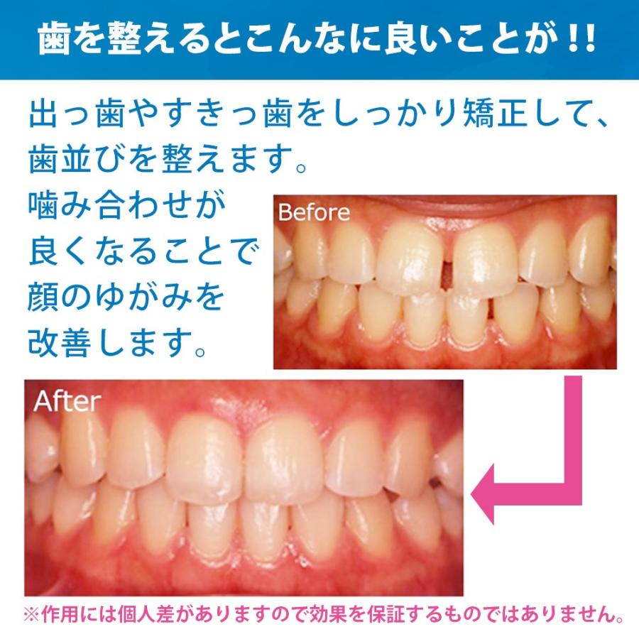 代引可】 最安値 マウスピース 快眠 睡眠いびき防止 噛み合わせ 透明クリア色