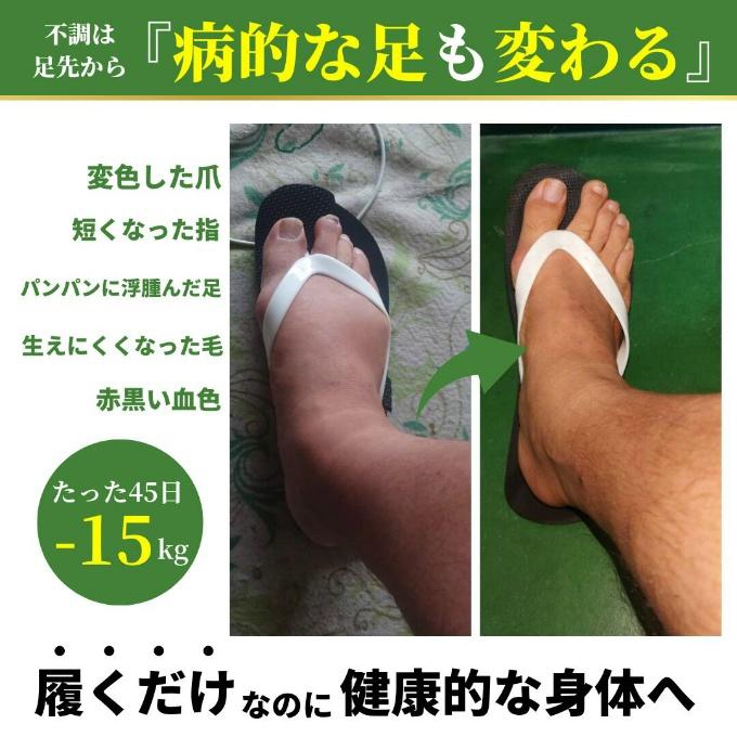 ラクバキ -5kgサンダル メンズ ダイエット 姿勢改善 外反母趾 ラクバキ -5kgサンダル メンズ ダイエット 姿勢改善 外反母趾