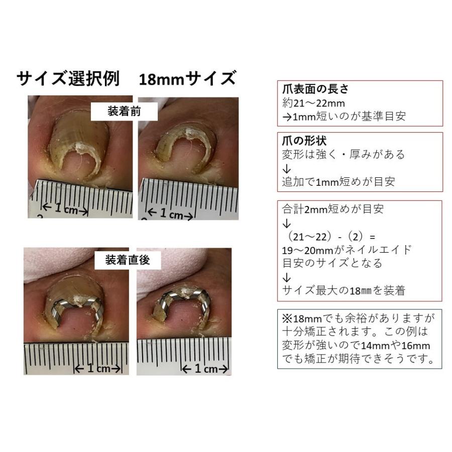 巻き爪 治し方 まきづめ 治療　　ネイルエイド １４ｍｍ　　自分で矯正 グッズ ワイヤー クリップ ガード 金具 リフト｜himawari-corp｜19