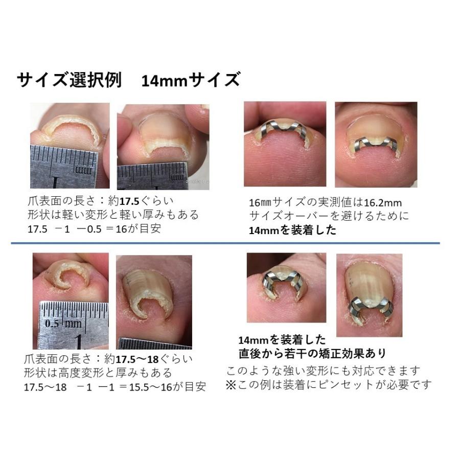 切り 方 爪 の 巻き