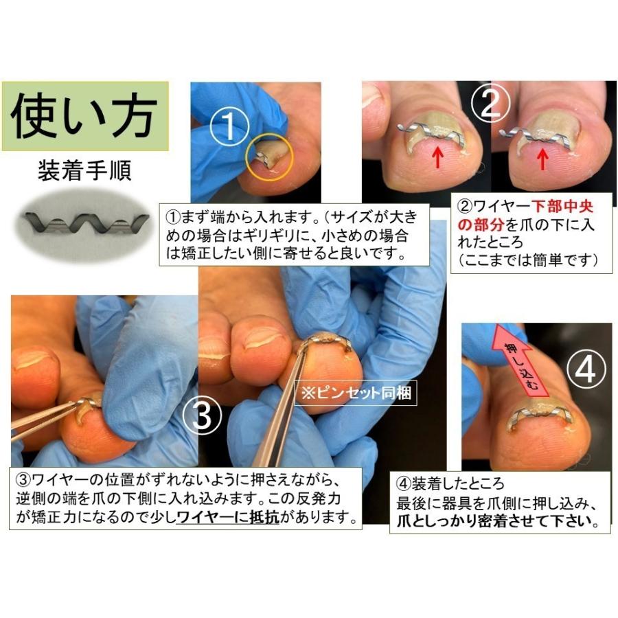 巻き爪治療 巻き爪矯正 自分で　　ネイルエイド １６ｍｍ　　ワイヤー クリップ 切り方 リフト 市販 グッズ｜himawari-corp｜08