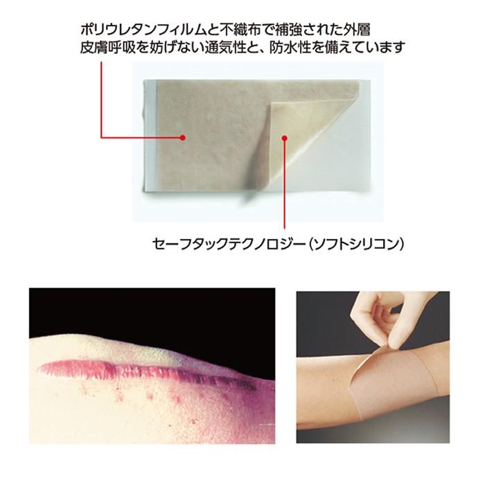 メピフォーム サイズ：5×7.5cm 入数：5枚 EOG滅菌済 品番：293200