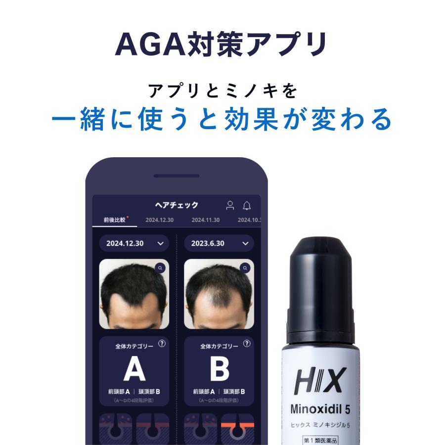 【6本】送料無料 ミノキシジル 5% HIX ヒックス ミノキシジル 5 60mL 6本 ミノキシジル 5% ミノキ 5 発毛剤 男性 育毛剤 hx10001006 | HIX | 10