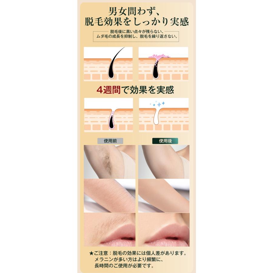 先着20名様限定5000円OFFクーポン】脱毛器 美肌 冷却機能 自動 先着20名様限定5000円OFFクーポン】脱毛器 美肌 冷却機能 自動