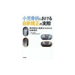 小児骨折における自家矯正の実際 骨折部位と程度からわかる治療選択 小児骨折における自家矯正の実際 骨折部位と程度からわかる治療選択