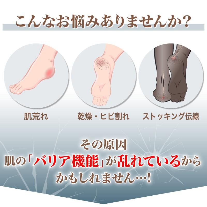 かかとクリーム かかと ひび割れ 尿素 ヒアルロン酸 馬油 薬用 ベ マン エクセレント クリーム 70g 日本製 ハンドクリーム 尿素 ヒアルロン酸 尿素 保湿 Fcc001 Vm ホビナビ 通販 Yahoo ショッピング