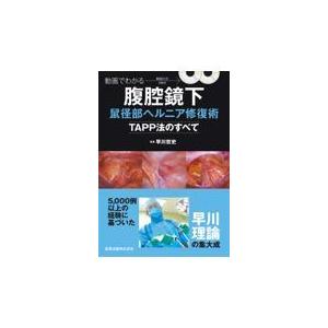 動画でわかる腹腔鏡下鼠径部ヘルニア修復術ーＴＡＰＰ法のすべてー/早川哲史
