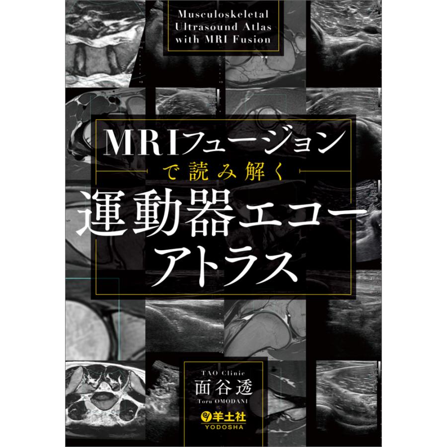 本 MRIフュージョンで読み解く運動器エコーアトラス