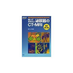 翌日発送・知っておきたい泌尿器のCT・MRI 改訂第2版/山下康行