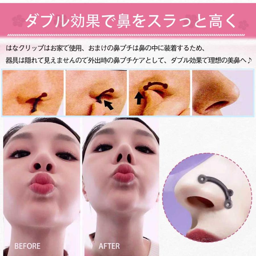 ノーズクリップ 小鼻 ノーズアップ 鼻クリップ 鼻筋美容