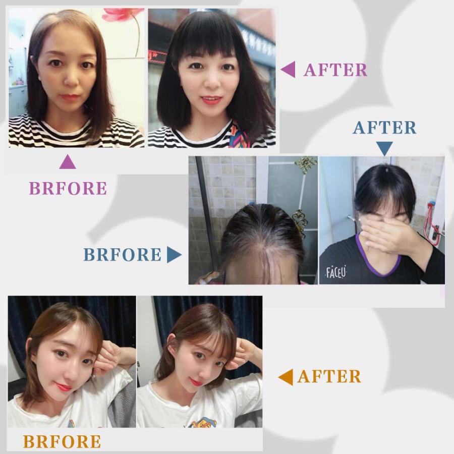 ヘアピース 人毛 部分ウィッグ ミディアム ブラウン つむじ ボブ 30cm 茶 ヘアピース 人毛 部分ウィッグ ミディアム ブラウン つむじ ボブ