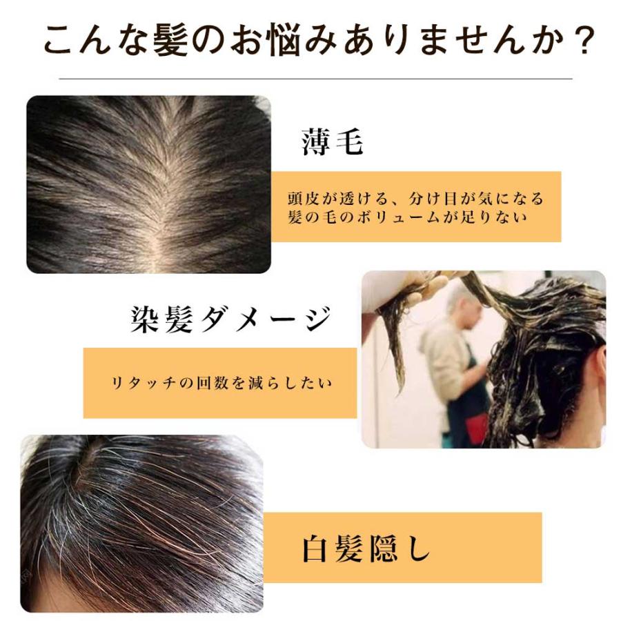 厳選ヘア 高品質 ヘアピース 人毛 100% 部分ウィッグ 薄毛隠し [30] ヘアピース 人毛100% 頭頂部 ウィッグ 自然 ミディアム 30cm