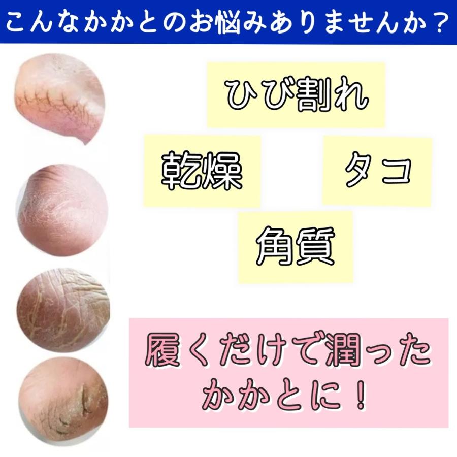 かかとケア靴下 2足セット ソックス かかと 角質ケア フットケア 男女兼用 カサカサ防止 ひび割れ防止 乾燥かかと 靴下 保湿 つるつる|hwings|02