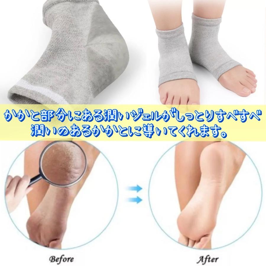 かかとケア靴下 2足セット ソックス かかと 角質ケア フットケア 男女兼用 カサカサ防止 ひび割れ防止 乾燥かかと 靴下 保湿 つるつる|hwings|03