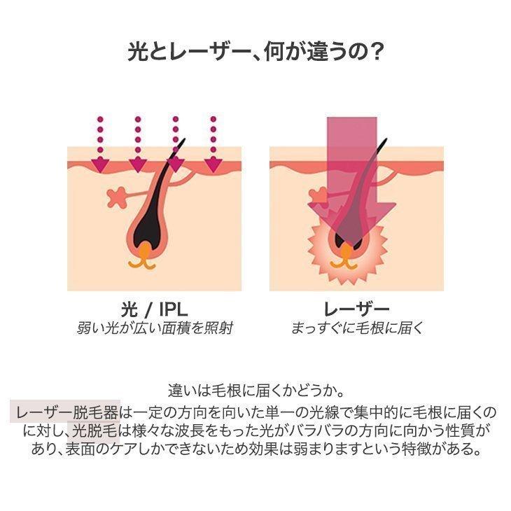 ＼ちょい生えムダ毛はレーザーにお任せ！／トリア パーソナルレーザー脱毛器 プレシジョン 30日間返金保証 ワキ 腕 脚 Vライン 全身脱毛 男女兼用 tria 直営店｜i-epi｜05