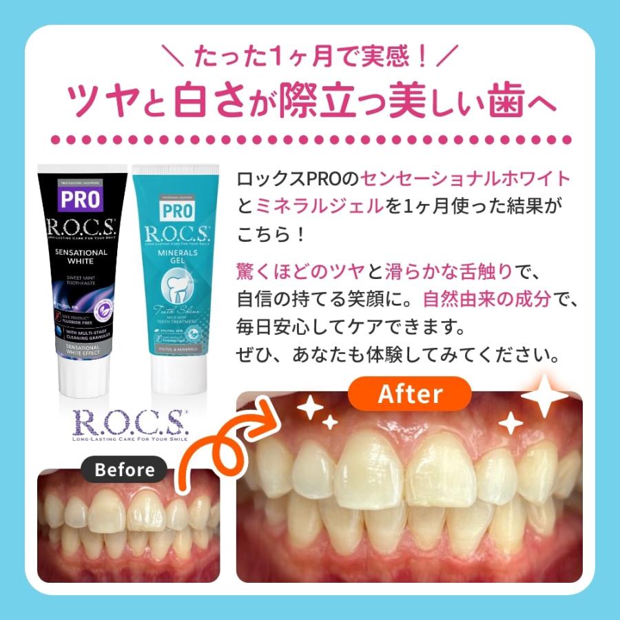 歯磨き粉 ロックスPRO MINERALS GEL ミネラルジェル 45g マイルドミント 3本 送料無料 一部除く アットイーハ - 通販 - Yahoo ショッピング