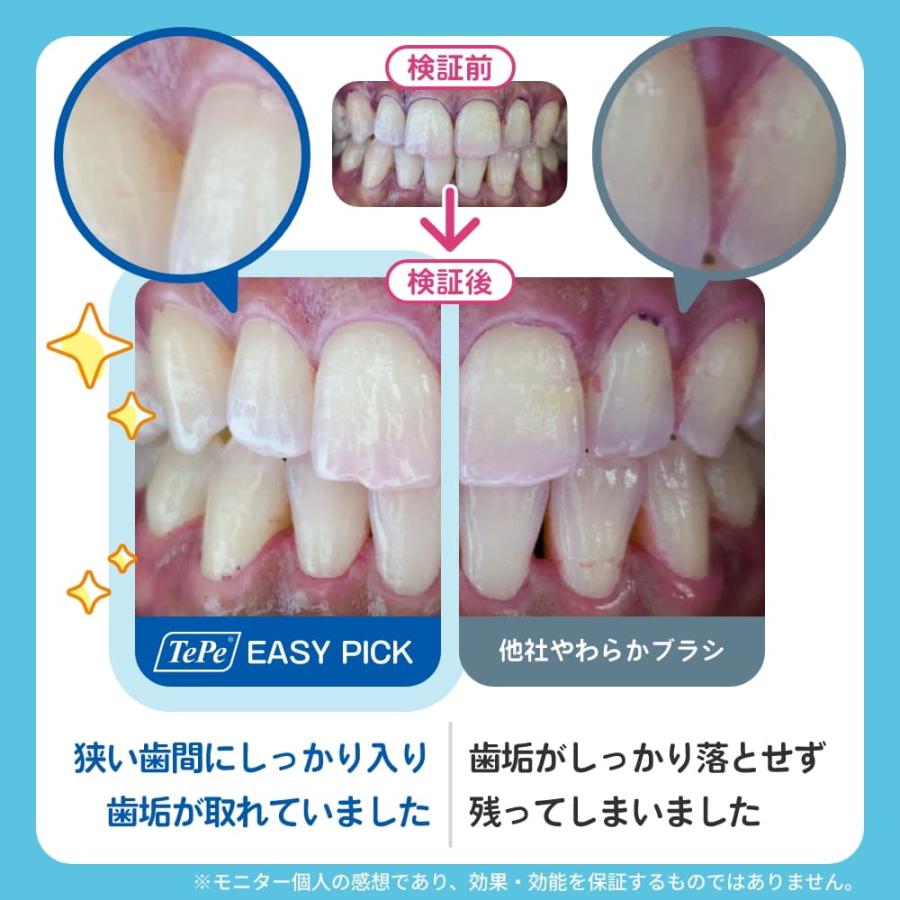 TePe 歯間ブラシ テペ イージーピック 1セット 36本+ケース M/L ブルー
