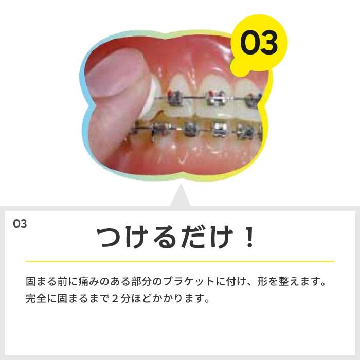 ギシグー　13本セット　新品未使用　GISHYGOO 松風 歯科印象用シリコーン GISHY GOO ギシグー ホワイト 5ml×1本