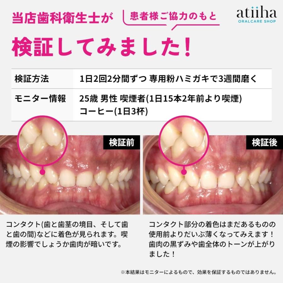 CURAPROX（クラプロックス） 今なら専用粉はみがき1個付き 音波電動