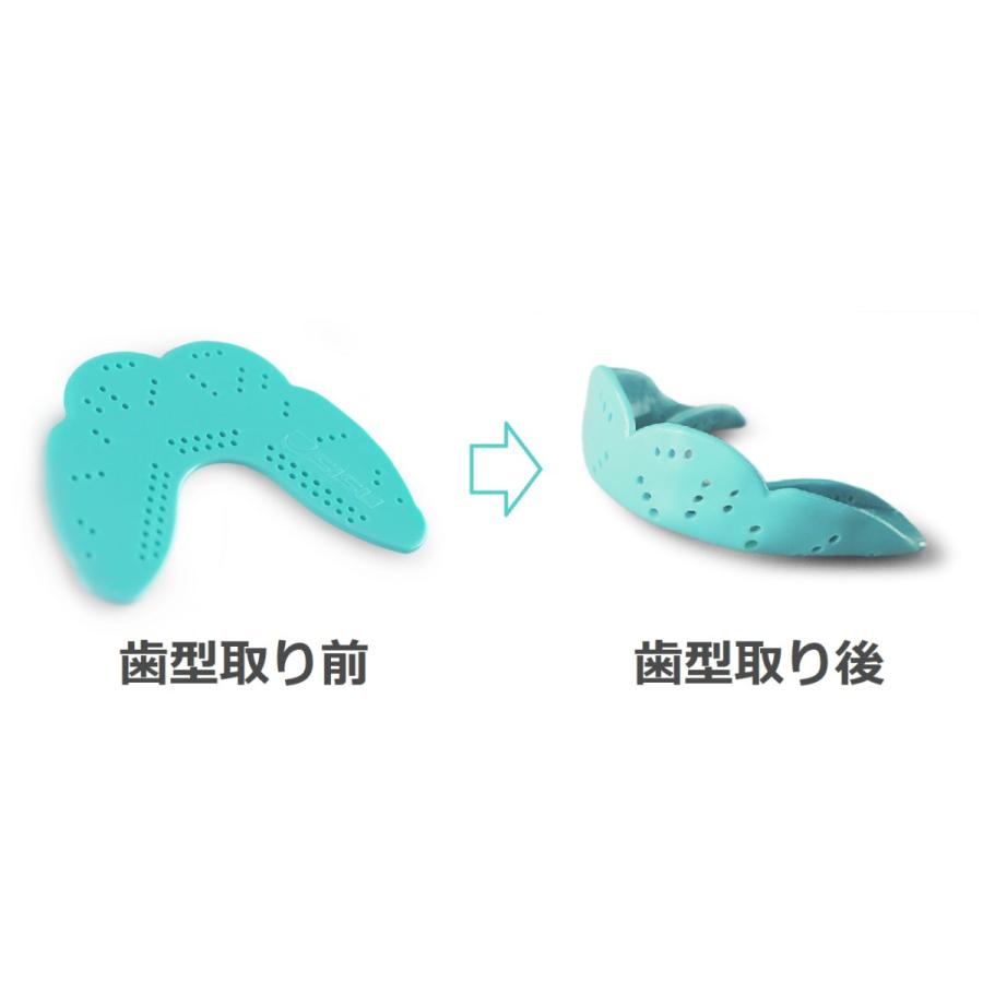 スポーツマウスピース SISU AERO 米国製 M L シス マウスガード 1.6mm
